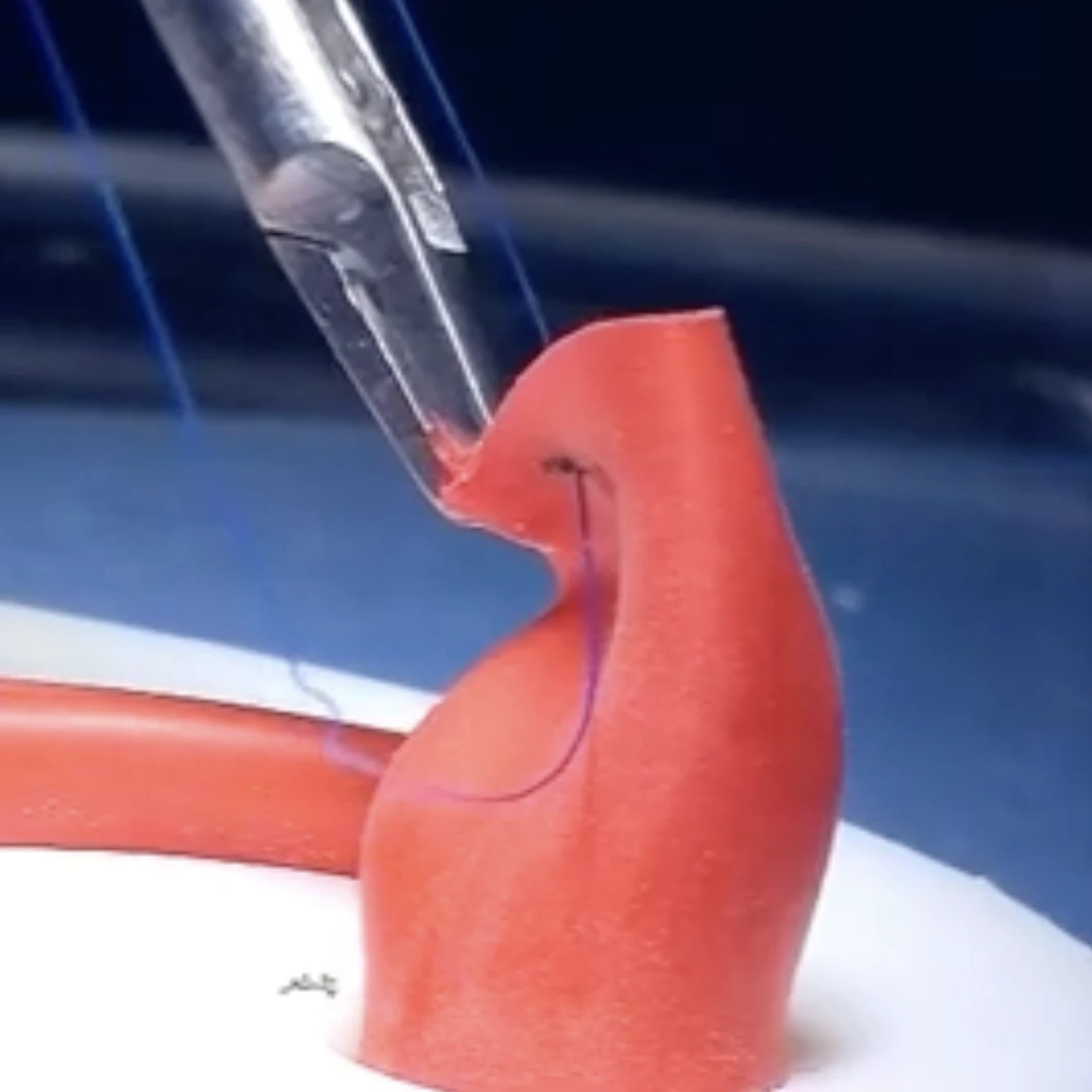3D 列印用於微創手術的創新縫合裝置